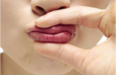 ]|blistexС׹ܣI(y)ڼtףٸɵĿڼtҲ
